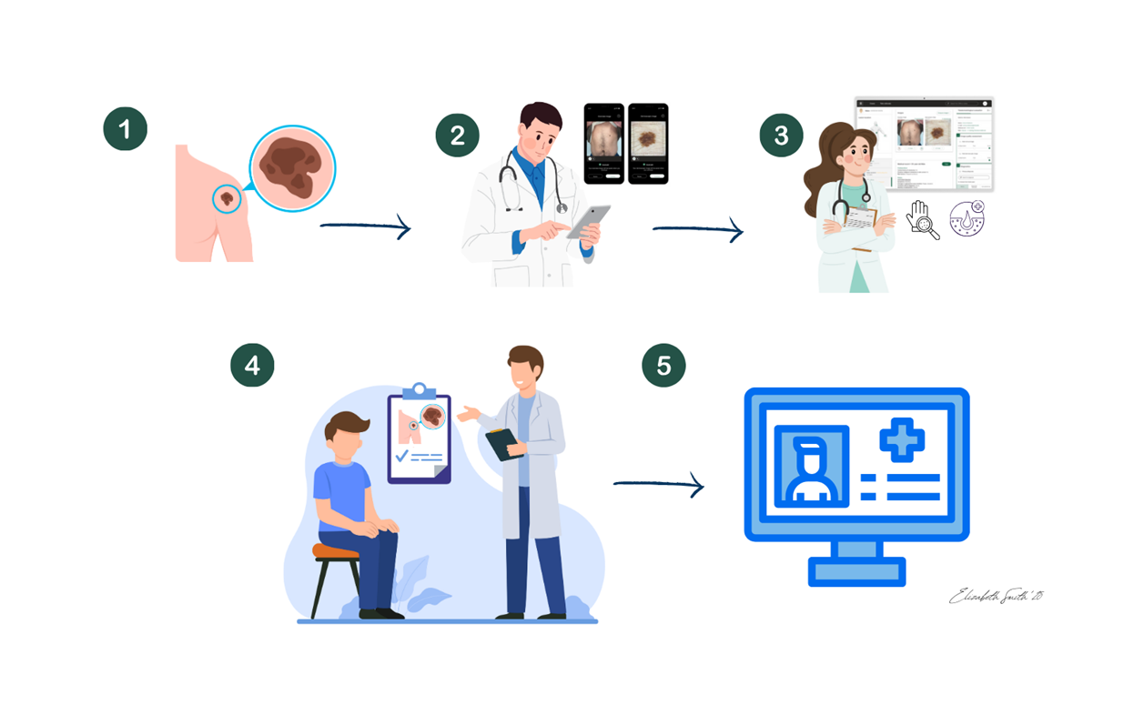 Process of Dermloop exam
