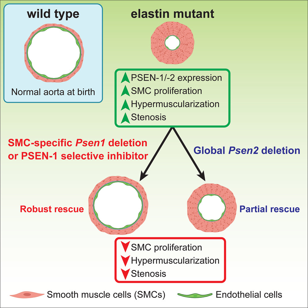 Presenilin-1 in smooth muscle cells facilitates hypermuscularization in elastin aortopathy. iScience. 27(1):108636. 2024.