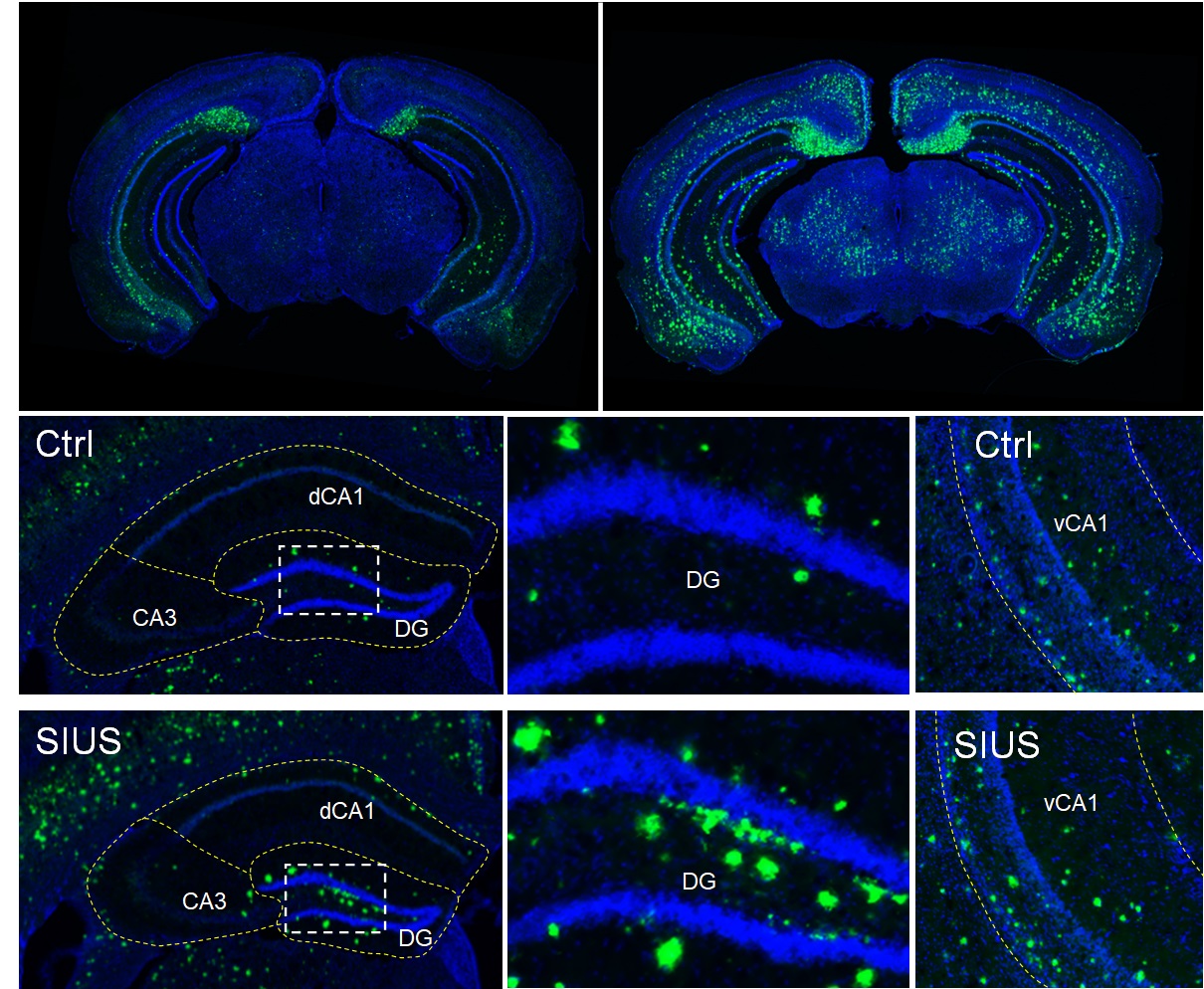 My lab studies how chronic social isolation-unpredictable stress (SIUS) accelerates aging and contributes to the onset and progression of Alzheimer’s disease (AD). We are particularly interested in how chronic stress induces persistent changes in epigenetic regulation, such as histone acetylation and methylation, in specific neuronal populations within brain regions affected in the early stages of AD, and how these molecular alternations increase cellular susceptibility to degeneration, leading to cognitive impairment and the exacerbation of amyloid-β and tau pathology.